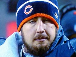 Kyle Orton, aka "Neck Beard"